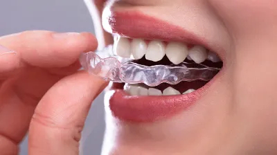 Woman putting on mouth guard