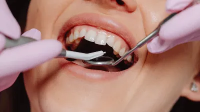 woman doing oral examination at the dentist
