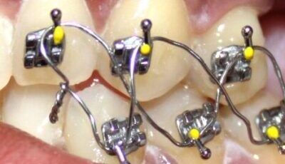 Dentist In Pretoria Highly Rated Book Online Now