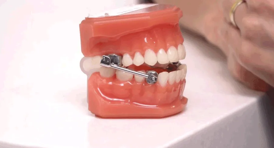 fake teeth jaw wiring concept