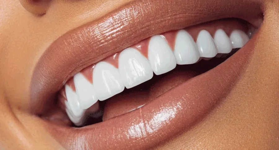 whitened teeth close up smile