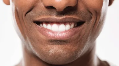 black smiling with white teeth