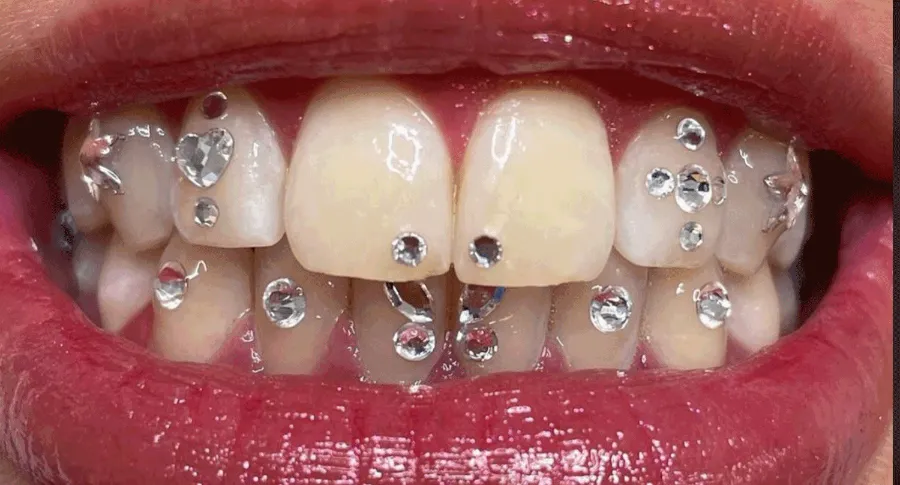 Teeth with teeth jewellery