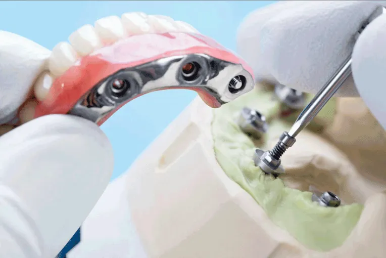 dentist reparing dentures