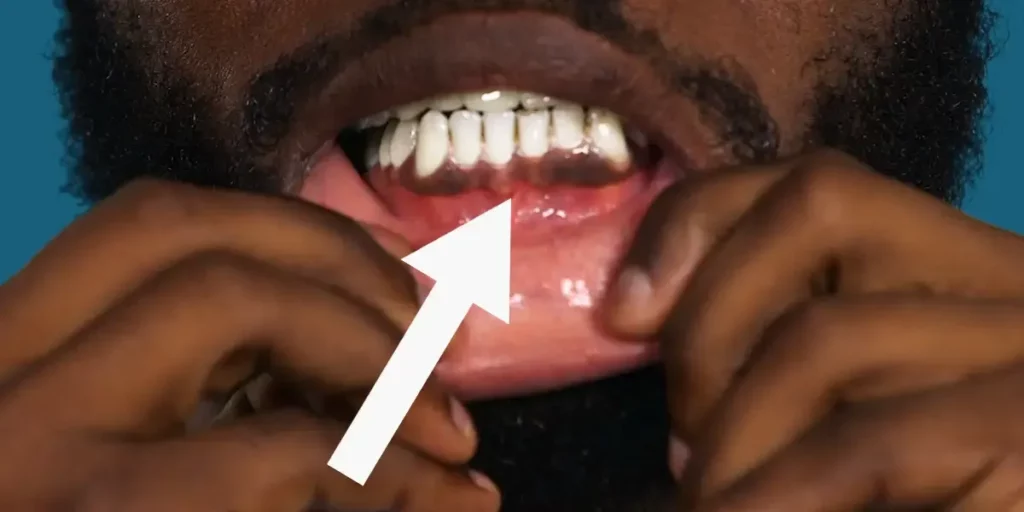 man showing black gums