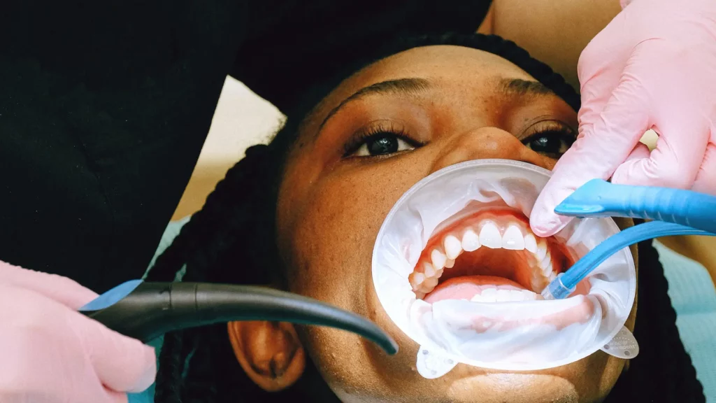 Teeth Cleaning Closeup