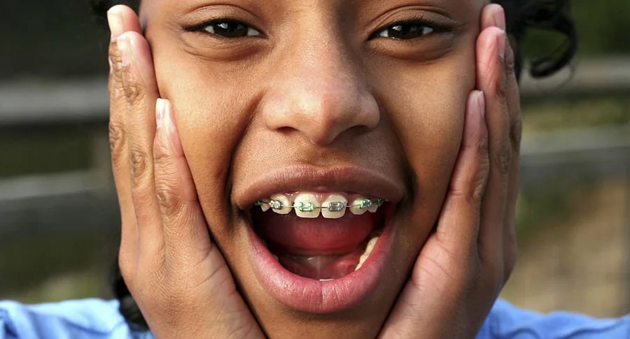 girl smiling with braces