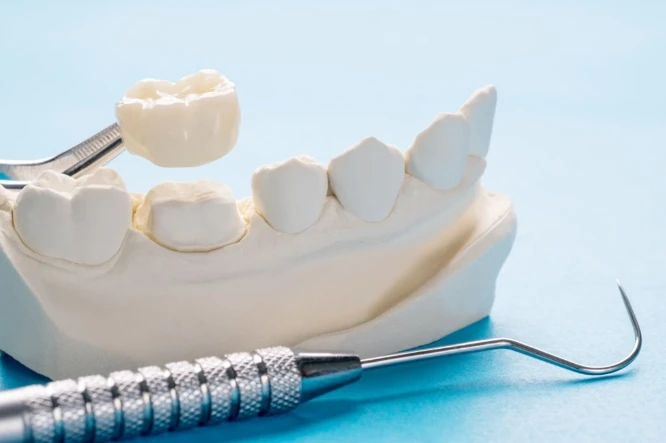 Dental crown sample on the table
