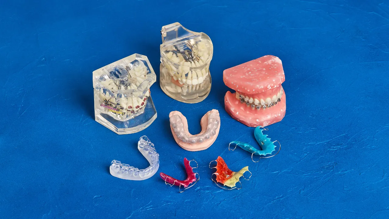 Slimming Wires vs. Traditional Braces| A Comparative Guide