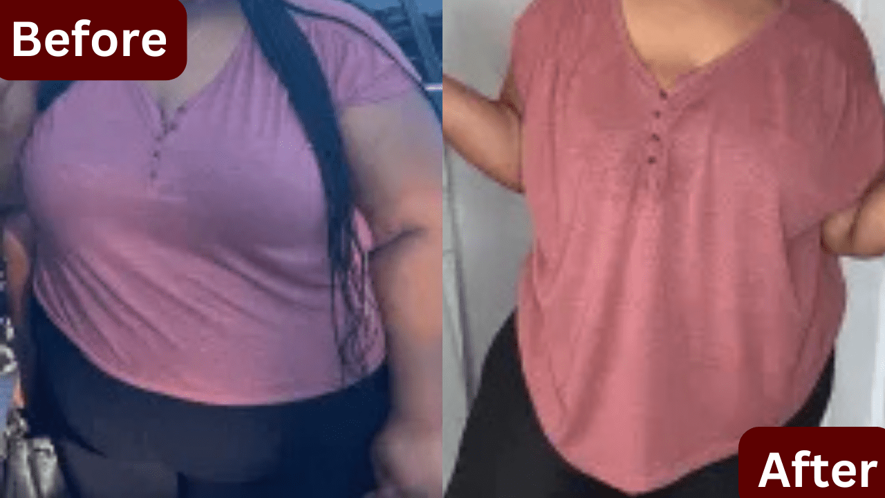 Slimming Wires In Port Elizabeth Weight Management