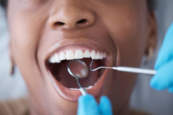 nice teeth in practice
